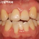 오승훈치과의원 네이버블로그