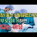 충수 (맹장)이하는일 이미지