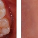 메이트치과기공소 이미지