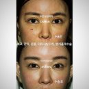(주)두한 - 천안시 동남구 | 부위별 맞춤 지방이식 두한성형외과 진솔리얼후기