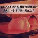 모든치과기공소 이미지