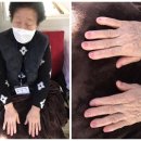 금비네일