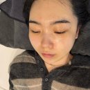 피부학교 | 부산 여드름 압출 후 엑소좀 장벽케어 후기! 문제성 피부 피부 전문 에스테틱샵 ‘피부학교‘