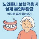 틀니