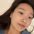 서울닥터우치과의원 | 압구정로데오 코셀라리프팅 후기｜닥터손유나의원 손유나클리닉 1회차 효과 미쳤다 진짜 ✨