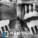 서울바정치과의원 이미지