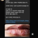 대구입술문신 추천 뷰티안젤로 내돈내산 남자 후기(주차, 입술타투 칠곡입술문신)