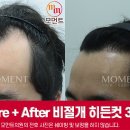 모먼트의원