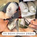라이프케어 | 안산 상록구 웨딩케어 뷰티라이프 윤곽관리 비대칭 관리 후기