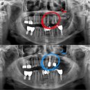 다올치과기공소 이미지