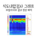 민병원 | 민병원 당뇨대사 수술 후기 1탄 - 수술전 검사