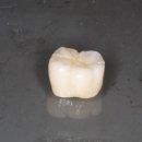 민치아치과기공소 이미지