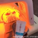 이리산소 이미지