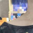 승모근으로 걸어다니는 사람 된 후기. 승모근 없애기 대작전