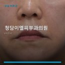 청담이엘피부과의원 | 청담이엘피부과의원 진료 과목 및 이용 안내