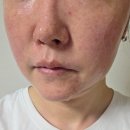 봄햇살약국 | 엑쎄라피 써클샷 4주차 후기