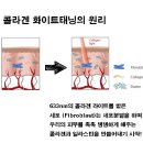 송도피부관리 에스떼리밋