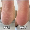 닥터아이티엔 공감네일 | 창원 사림동 네일 닥터아이티엔 공감네일 발 관리 후기
