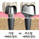 미소가득치과 이미지