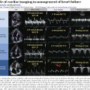 Role of cardiac imaging in management of heart failure 이미지