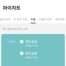 서초제일약국 | 초고도근난시 강남 비앤빛안과 렌즈삽입술 후기 내돈내산