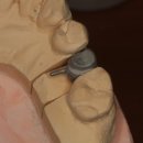 민치아치과기공소 이미지