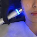씨유구미형곡시장점 | 구미 형곡동 문제성 피부 케어 피부관리샵 후기 / 은블랑