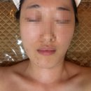심미안 | [수원시청에스테틱] 인계동신부관리 유명한 심미안에스테틱 후기