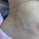제시뷰티포항1호점 메이크윤 | 포항피부관리 쥐젖 고민하지말고 바로 제시뷰티 메이크윤 포항1호점으로 고고~~