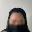 에이원헤어라인 이미지