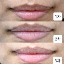 아우름의원 이미지