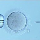 시험관 시술와 자연 수정의 난자 형태 차이 비교 이미지