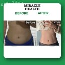 미라클 헬스 이미지
