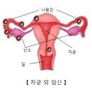 질 Daum백과