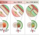 혈관관리는 건강의 시작 혈관 막힘의 과 혈관관리에 좋은음식 이미지