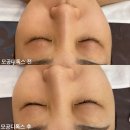 위례피부관리 올가드림뷰티 송파위례점 모공디톡스 후기🌷
