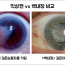 새봄안과 이미지