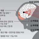 [서울대 소식] 연구 ＞ 연구성과 | 항공우주공학과 여재익 교수 연구팀 / 절개 수술 없이 뇌질환 안전하게 치료하는 미세 충격파 전자 이미지