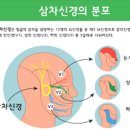 얼굴을 찌르는 듯한 통증 삼차신경통 증상 및 원인 치료 3차신경통 이미지