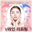 비케이한국성형 | 비케이성형외과 실리프팅 성공적♡