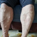 리얼클린족욕 이미지