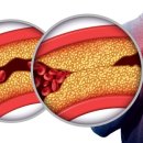 인터케어 이미지