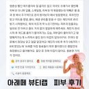천지인한방병원 | 피부관리후기좋은곳 광주동구학동피부관리실 아레떼 뷰티랩
