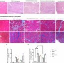미다스의원 | "빠를수록, 꾸준할수록 좋다" 줄기세포 치료의 골든타임