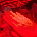 비메디컴퍼니 | 메디아워 적외선 재활통증치료기 조사기