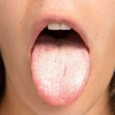 혀를 보면 건강 알 수 있다? 이미지