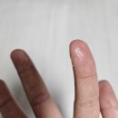 (주)유케이 | 닭살피부, 등드름 고민을 해결해줄 유케이스크럽 제품 사용 후기