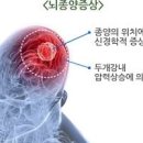 뇌종양 초기 및 원인 수술 , 사망률 (악성 양성) 이미지