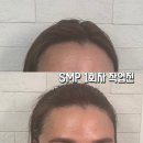 (주)기장교통 | 부산탈모커버후기 탈모커버 헤어라인커버 SMP 잘하는 부산리본도트