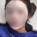 리뮤즈두피.탈모관리센터 네이버블로그